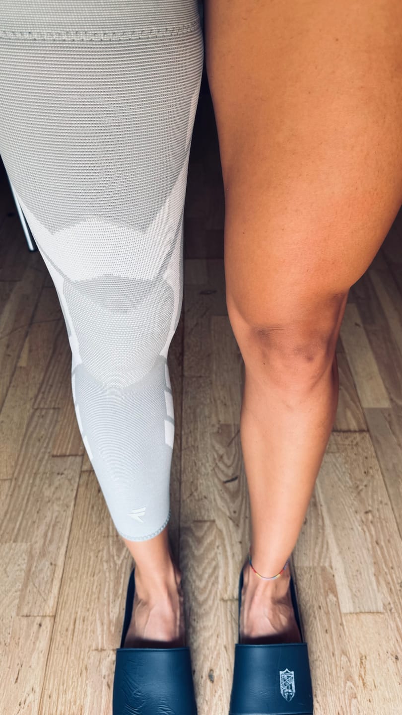 Customer photo review of Maintien de compression Été V2 pour Genoux et Jambes