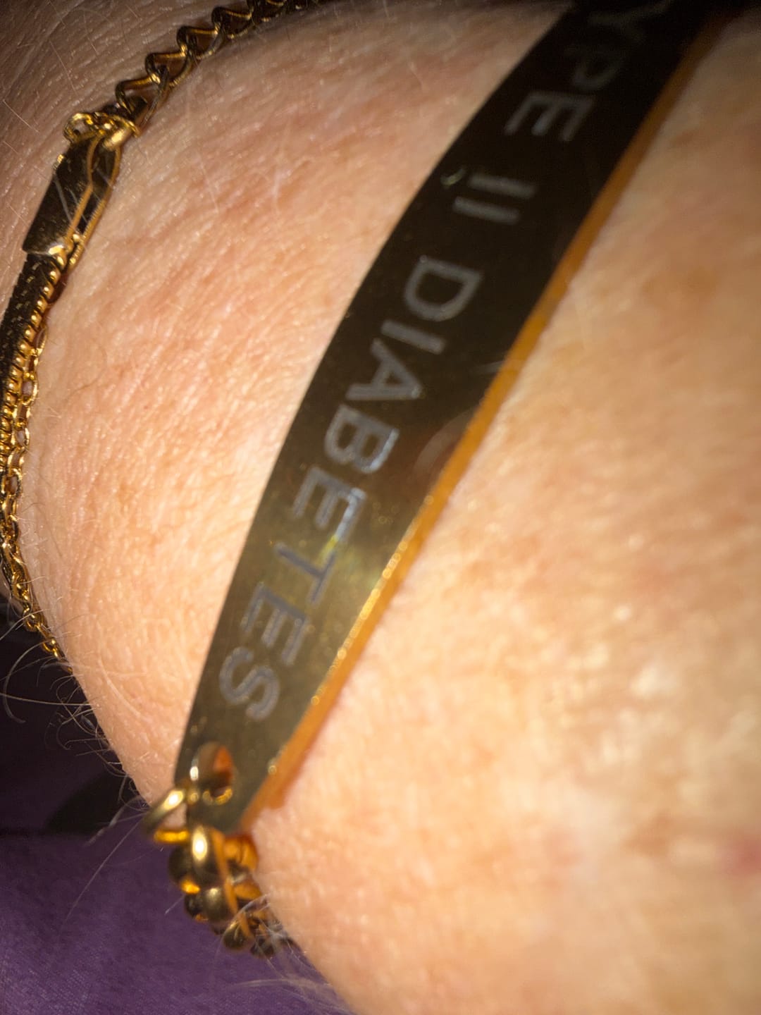 Customer photo review of Diabetes-Bewusstseins-Armband