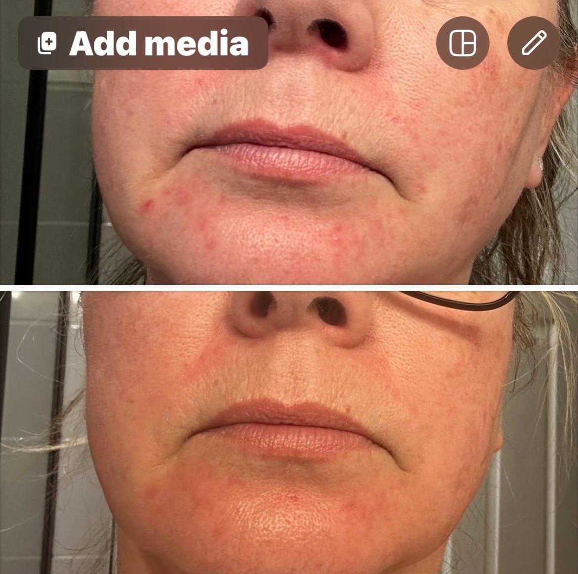 Customer photo review of Face Oil (Moisture Absolute)