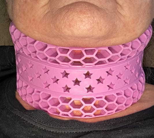 Customer photo review of CervicalEase Neck Support