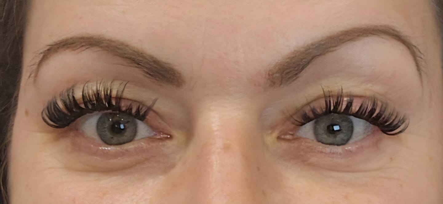 Customer photo review of NO FILTER STARTER KIT (12mm-14mm)