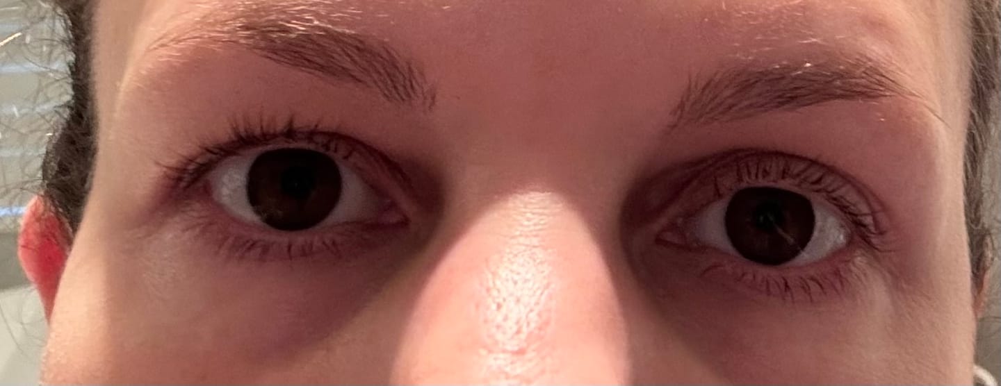 Customer photo review of Sea Cucumber Collagen Instant Lift Eye Serum