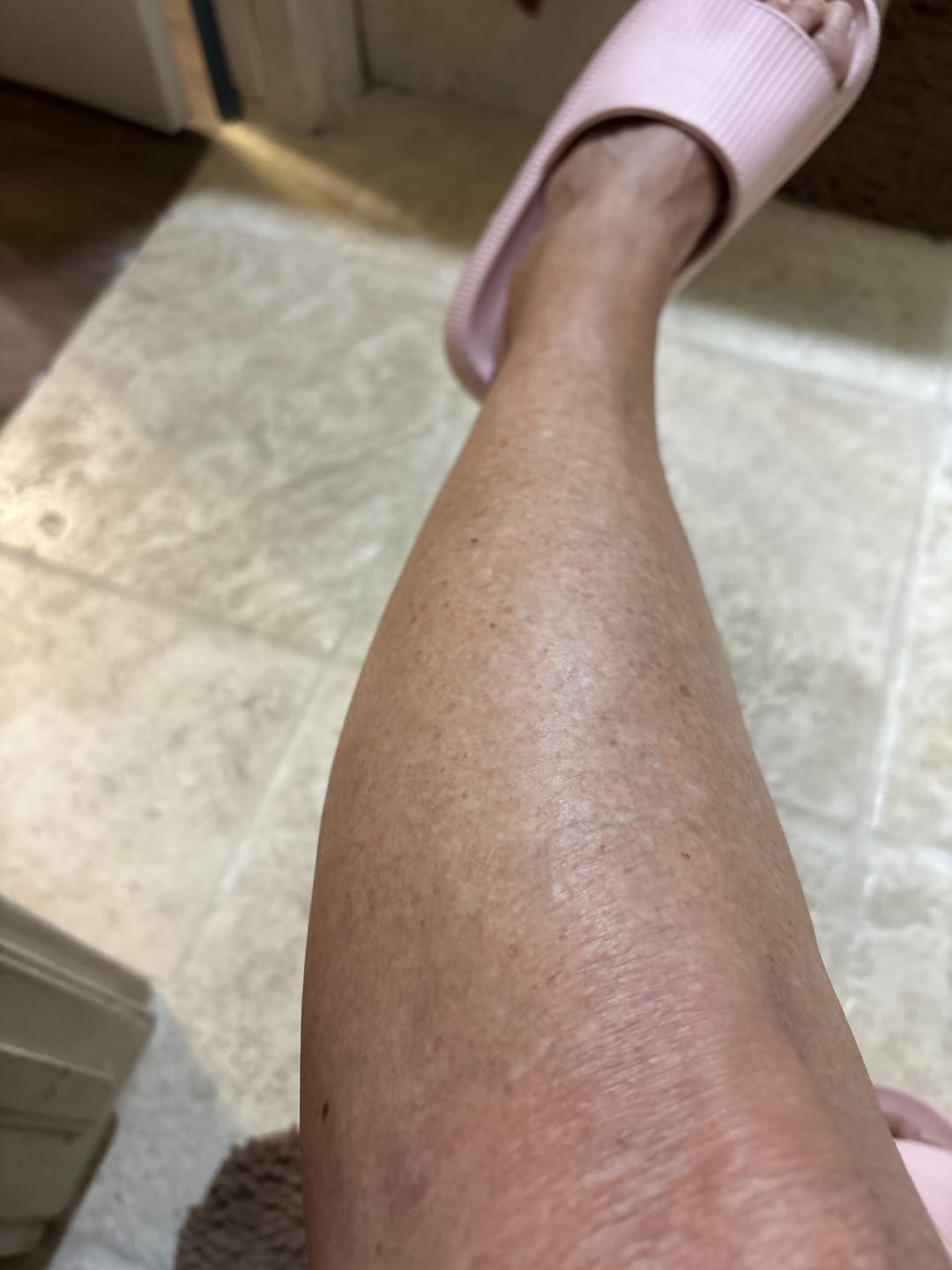 Customer photo review of Body Serum