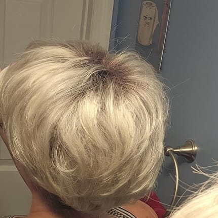 Customer photo review of Breathable&comfortable Short Hair Topper For Thinning Hair