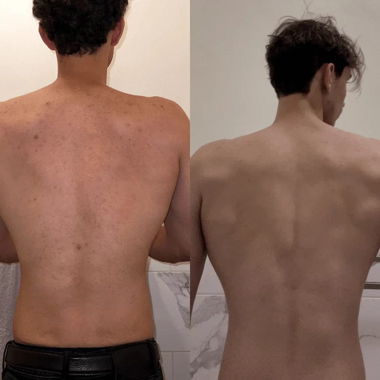 Customer photo review of Lucrown Body Acne Wash