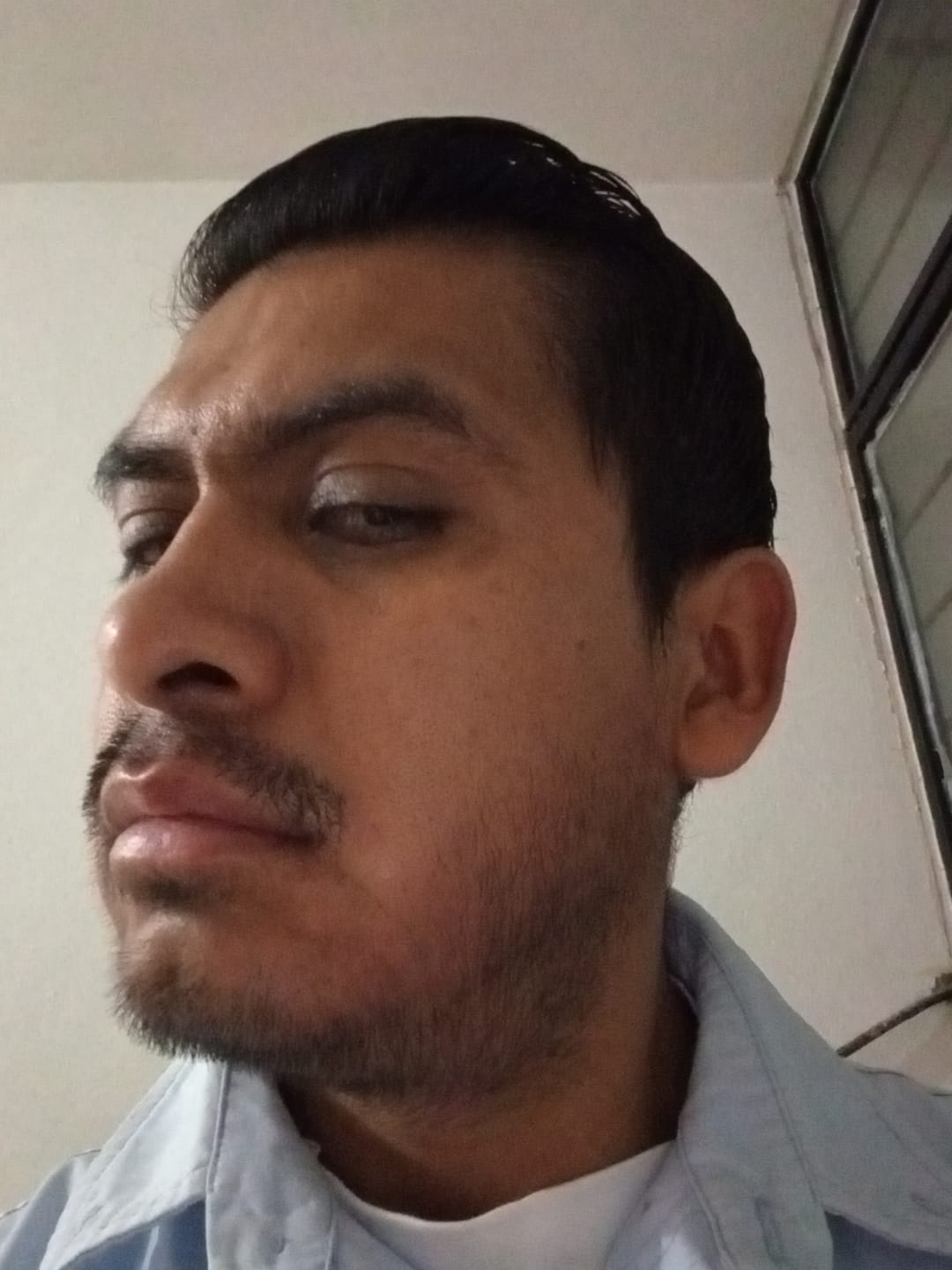 Customer photo review of Kit Barba Real | 2 Minoxidil al 20% +Biotina + Derma | El kit más Completo para crecimiento de Barba