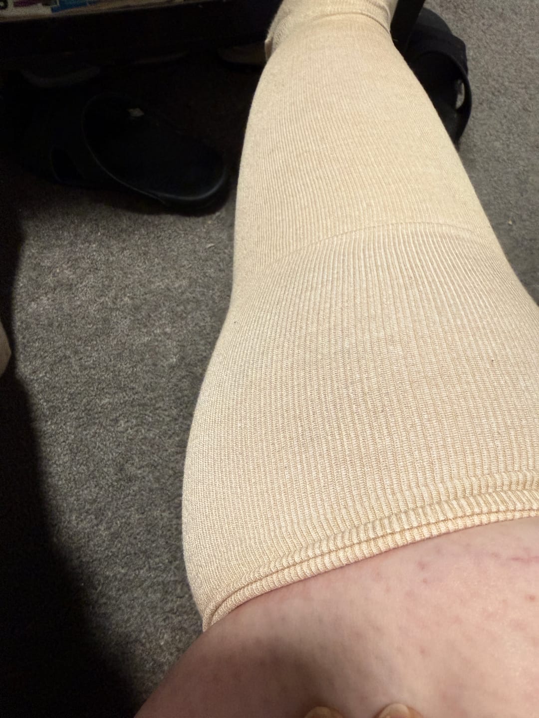 Customer photo review of Bamboo Wide Compression Socks