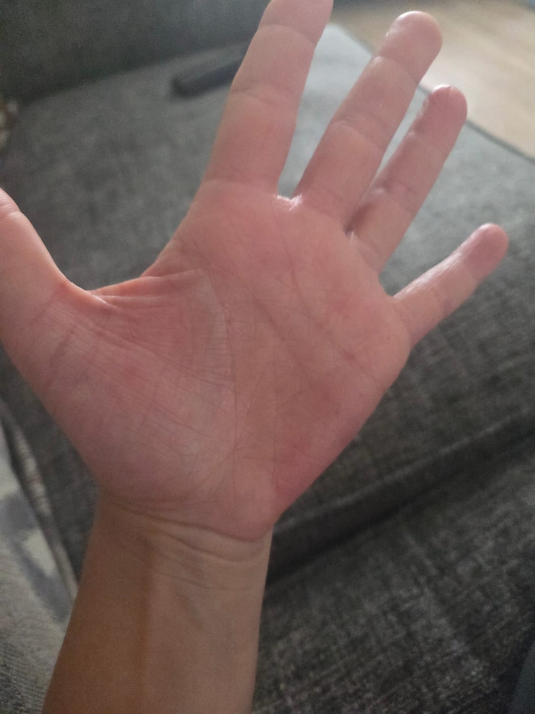 Customer photo review of Multi Strain Biotic