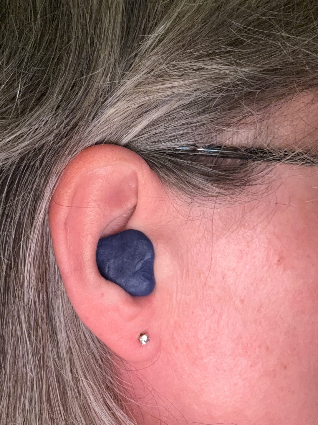 Customer photo review of SoundBloc Silicone Earplugs - Side sleep comfort - 1 year supply