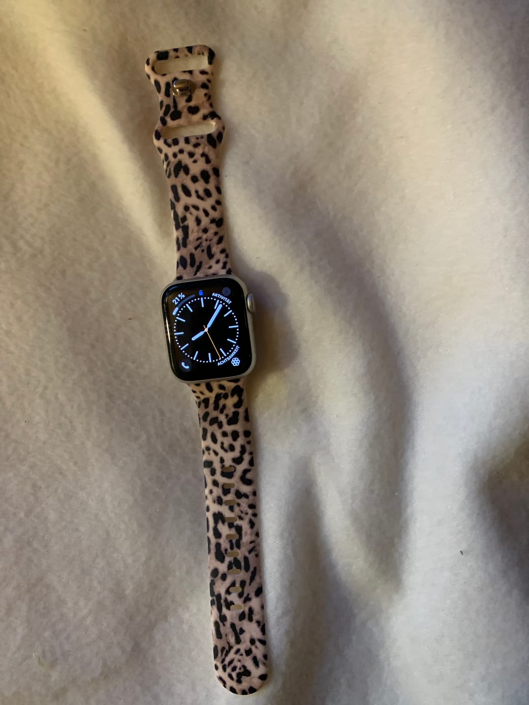 Customer photo review of arktisband Leopard Apple Watch Armband