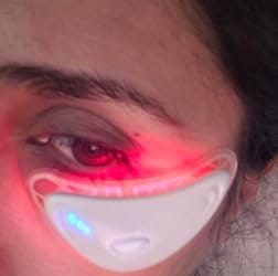 Customer photo review of LumiEyes™ Red Light Massager