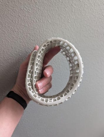 Customer photo review of CervicalEase Neck Support