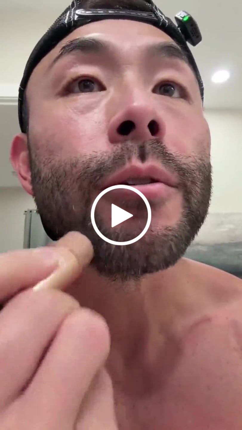Customer video review of Stick Corrector de Raíces y Canas