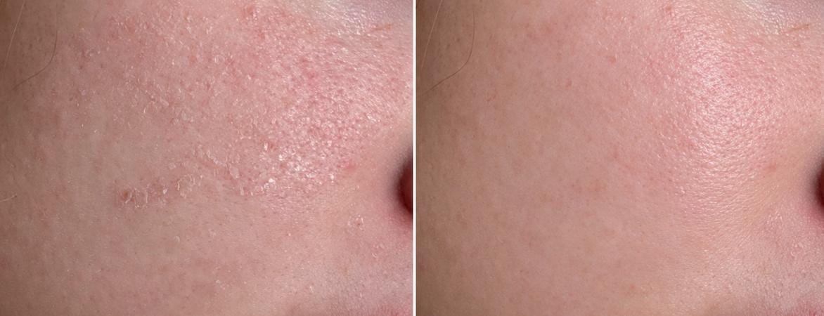 Customer photo review of Crema Viso con Acido Ialuronico e Retinolo