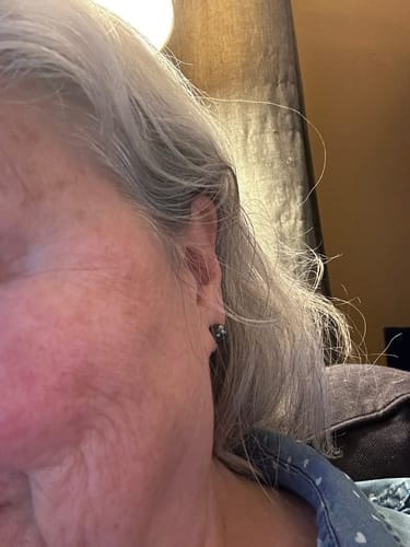 Customer photo review of Koriderm+™ Crema Antiedad Rejuvenecedora