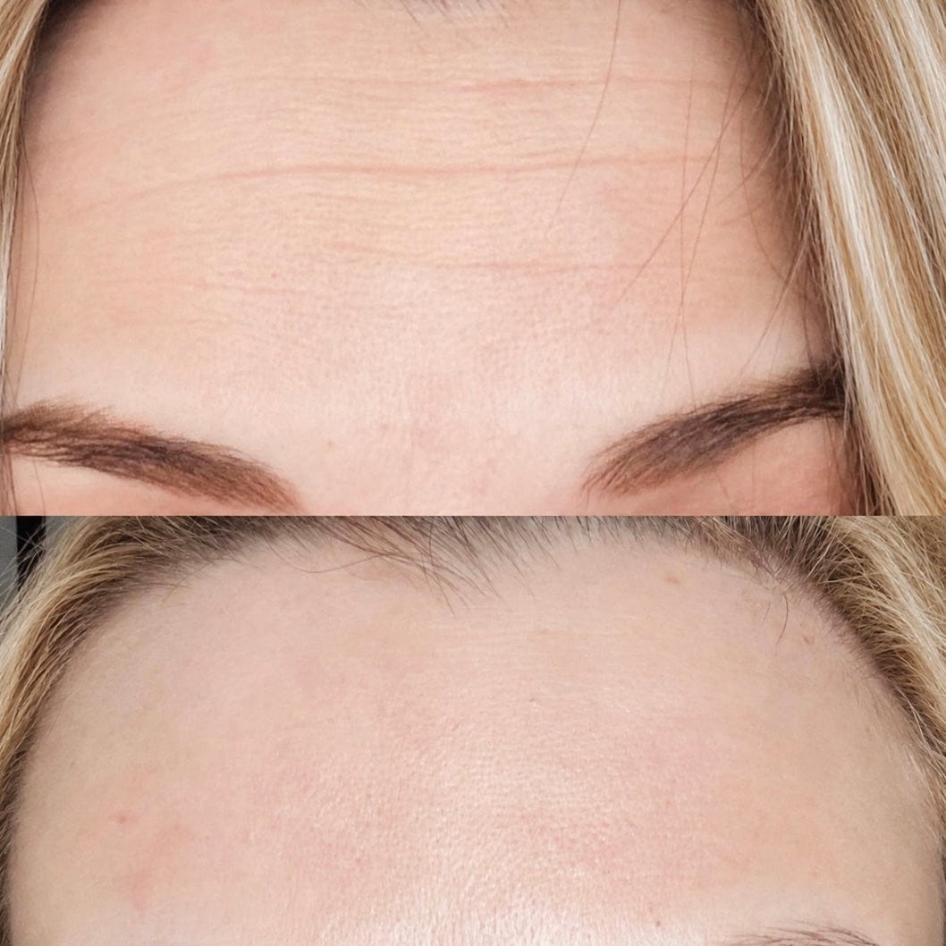 Customer photo review of Hyaluronic Acid and Peptides Eye Serum 30ml