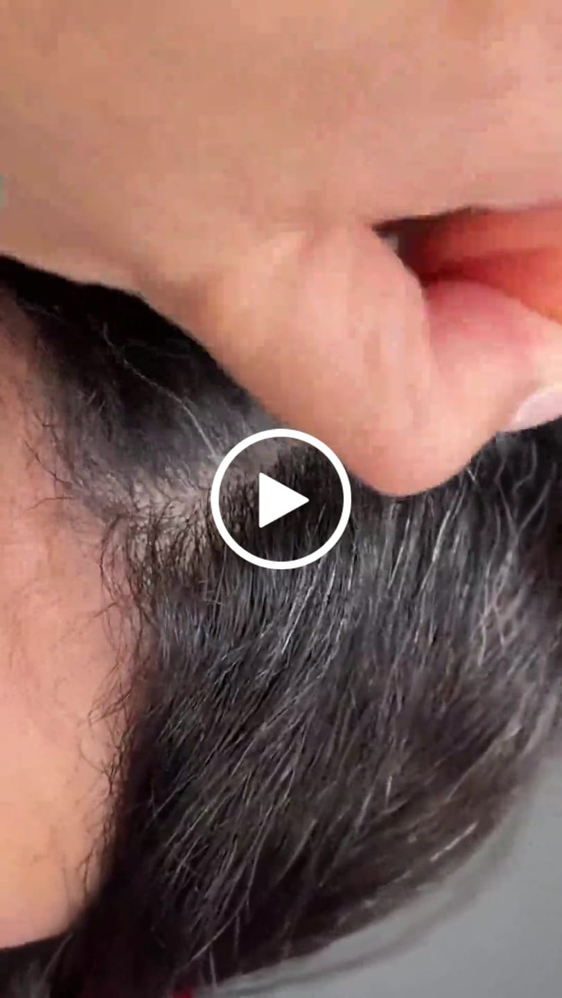 Customer video review of Stick Corrector de Raíces y Canas