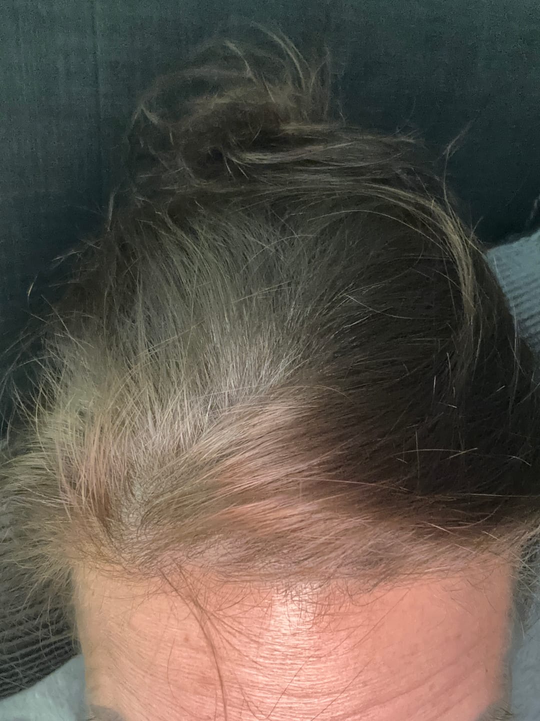 Customer photo review of Instant Dye Shampoo