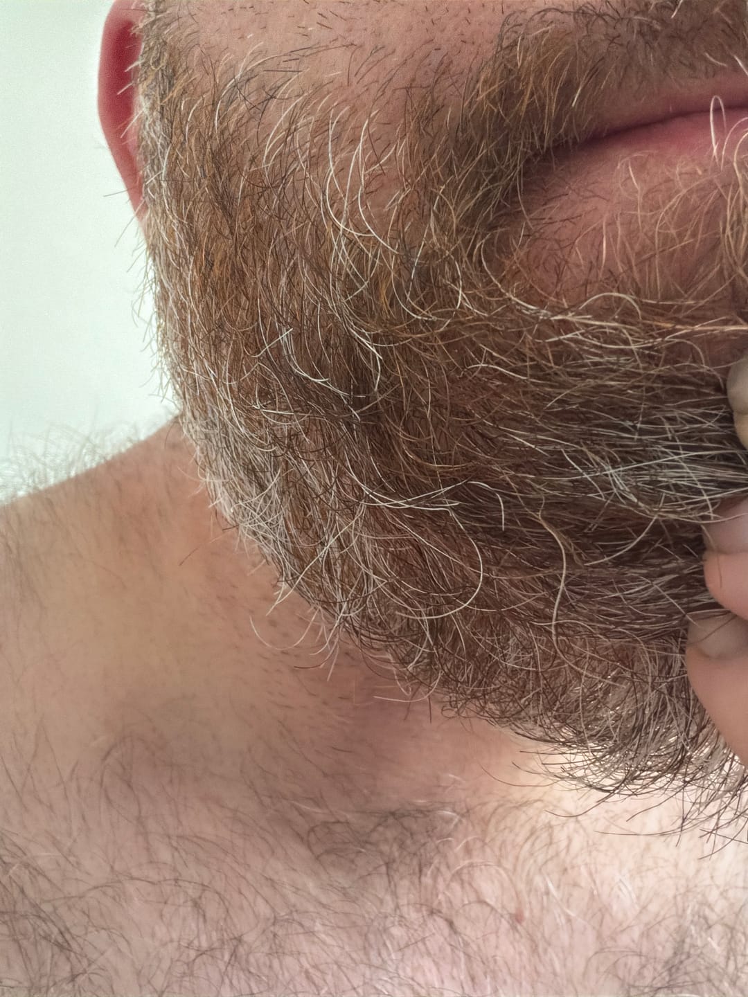 Customer photo review of Seb Natural Calming Serum