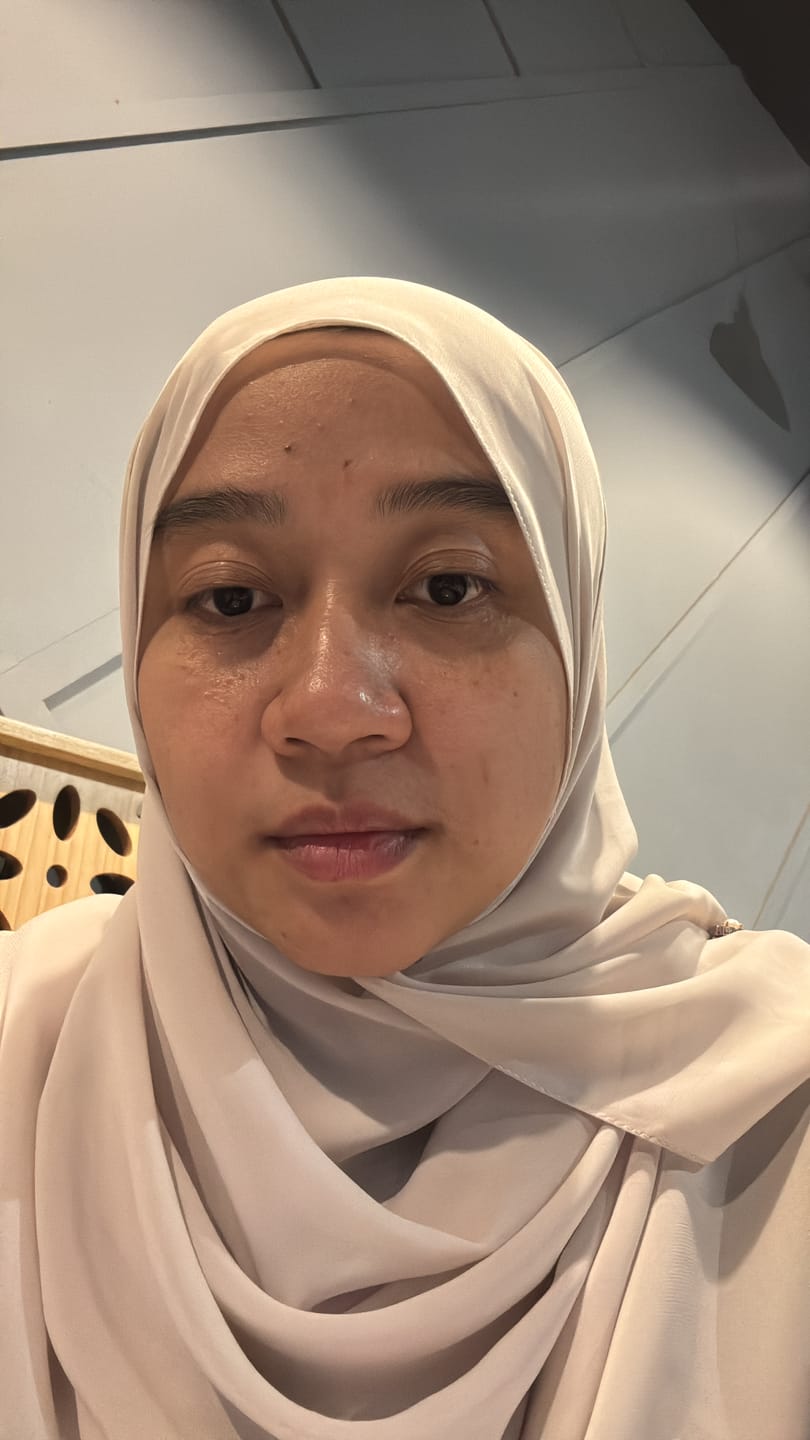 Customer photo review of Barrier Glow Kit