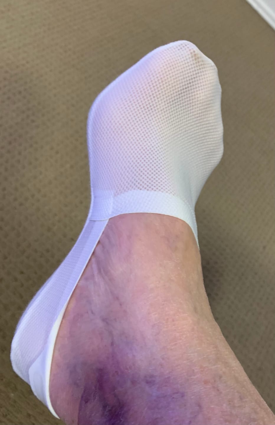 Customer photo review of BareLite Footies 3 Pack