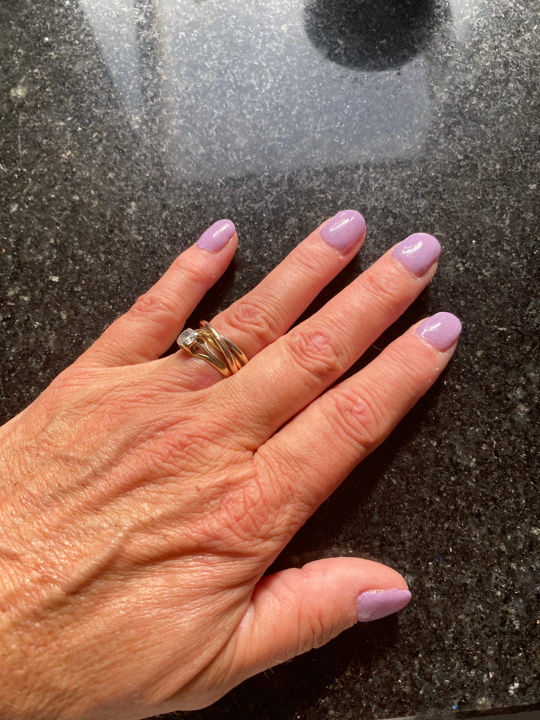 Customer photo review of Verzending Verzekering