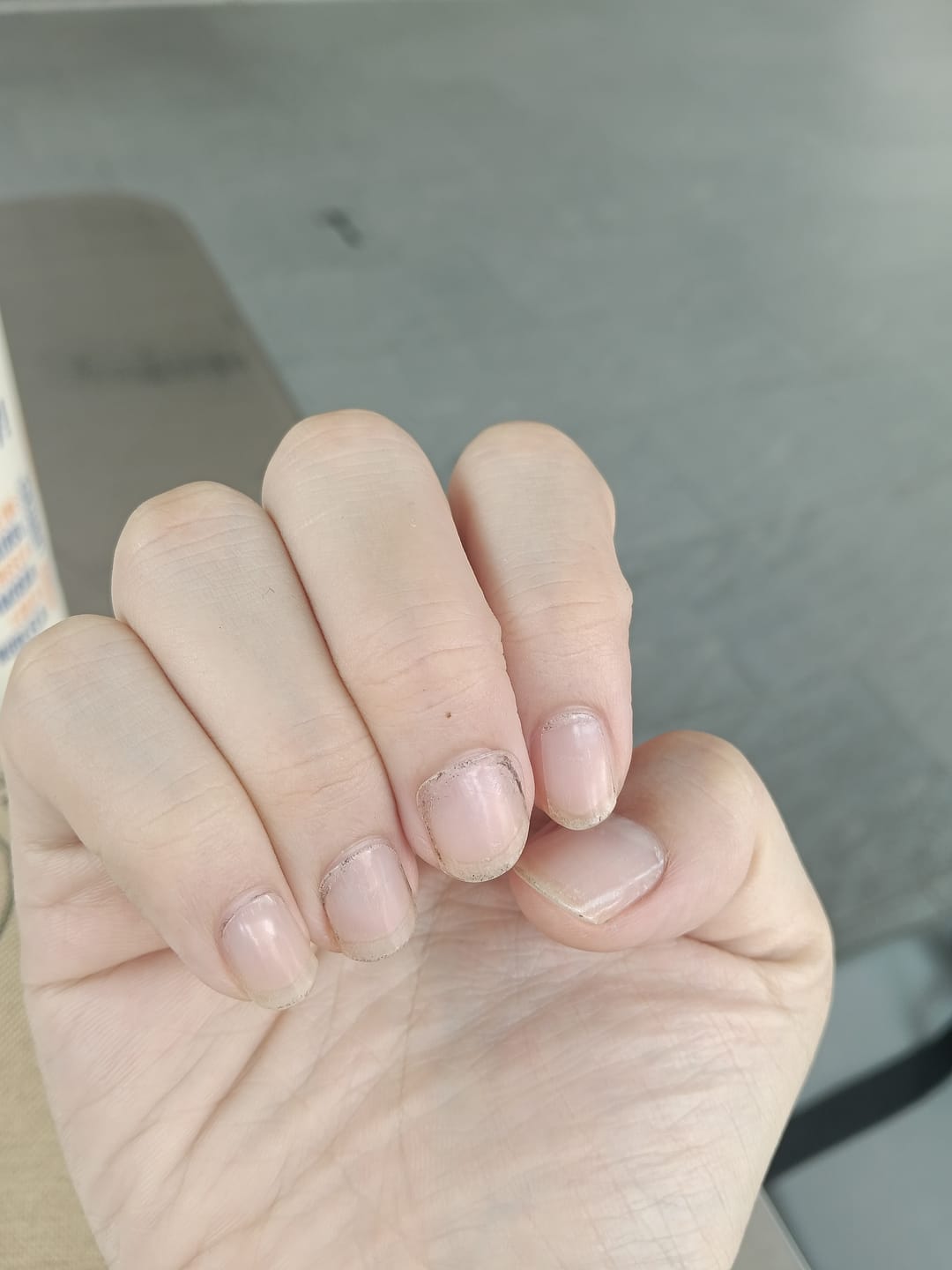 Customer photo review of Crystal Clear DIY Semicured Gel Nail Sticker Kit (STOP NAIL BITING & GROW BRITTLE NAILS)