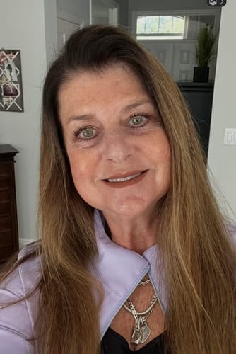 Customer photo review of Koriderm+™ Crema Antiedad Rejuvenecedora