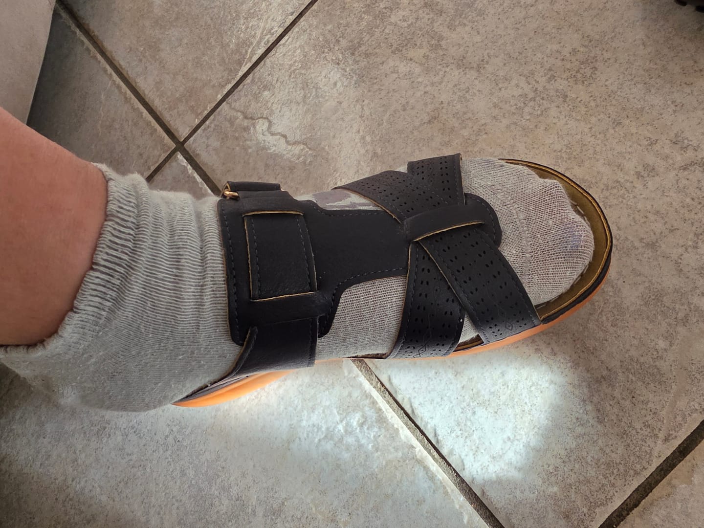 Customer photo review of Sandales orthopédiques Premium