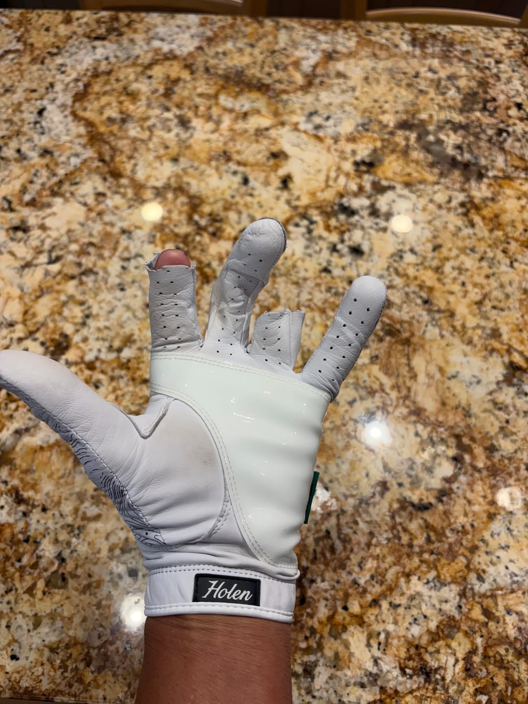 Customer photo review of Holen SureGrip Glove
