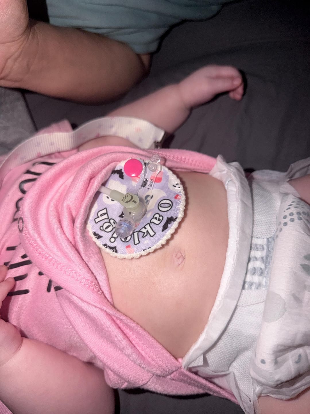 Customer photo review of Halloween Feeding tube pads