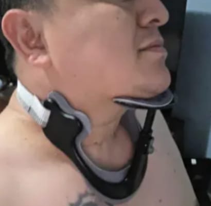 Customer photo review of Adjustable Neck Support Brace