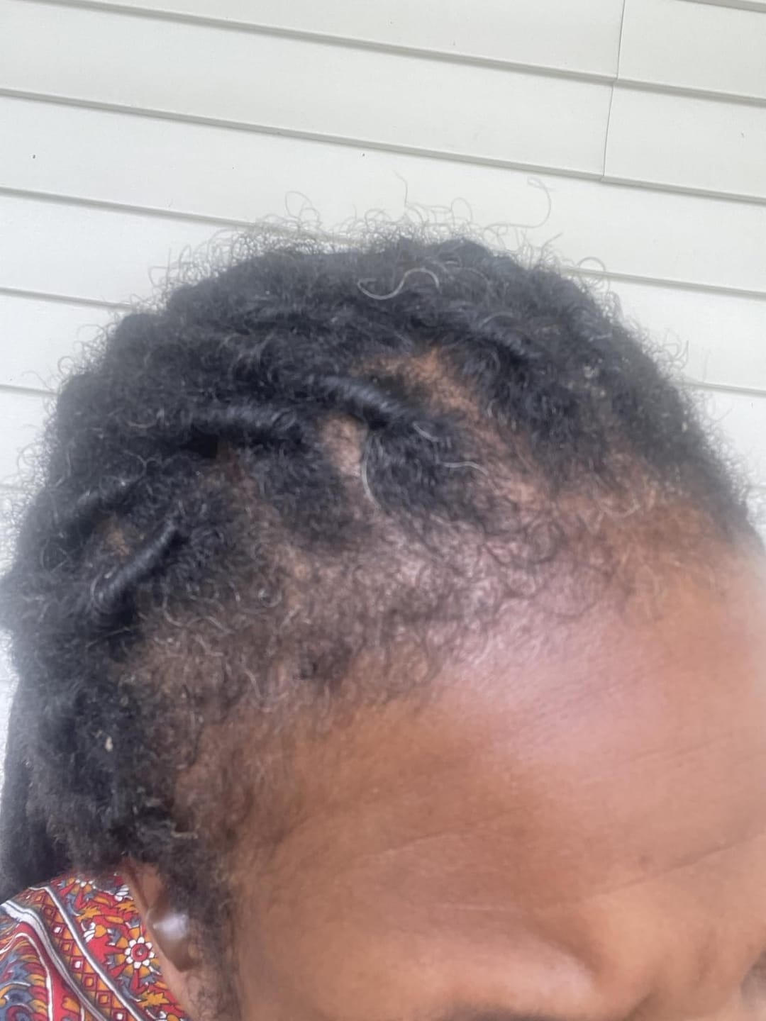 Customer photo review of Bodywise Hair Growing Serum