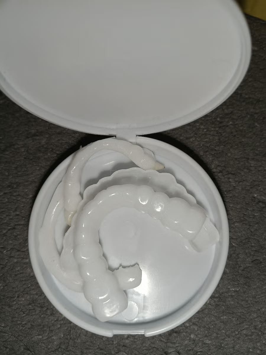 Customer photo review of Snap-On Veneers — Your Smile, Your Confidence (Pack of Two Veneers)