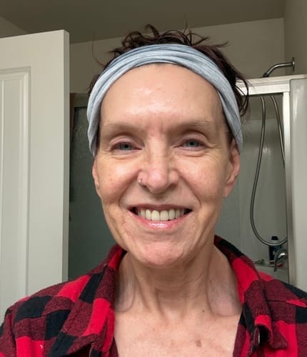 Customer photo review of Koriderm+™ Crema Antiedad Rejuvenecedora