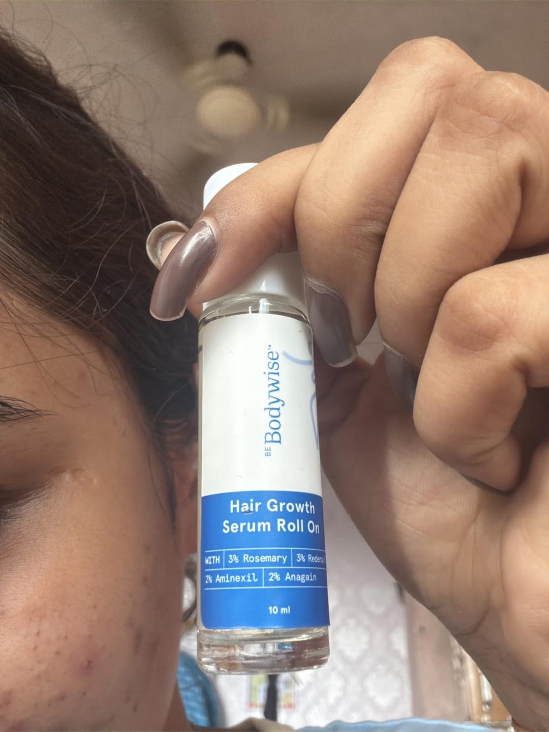 Customer photo review of Bodywise Hair Growing Serum