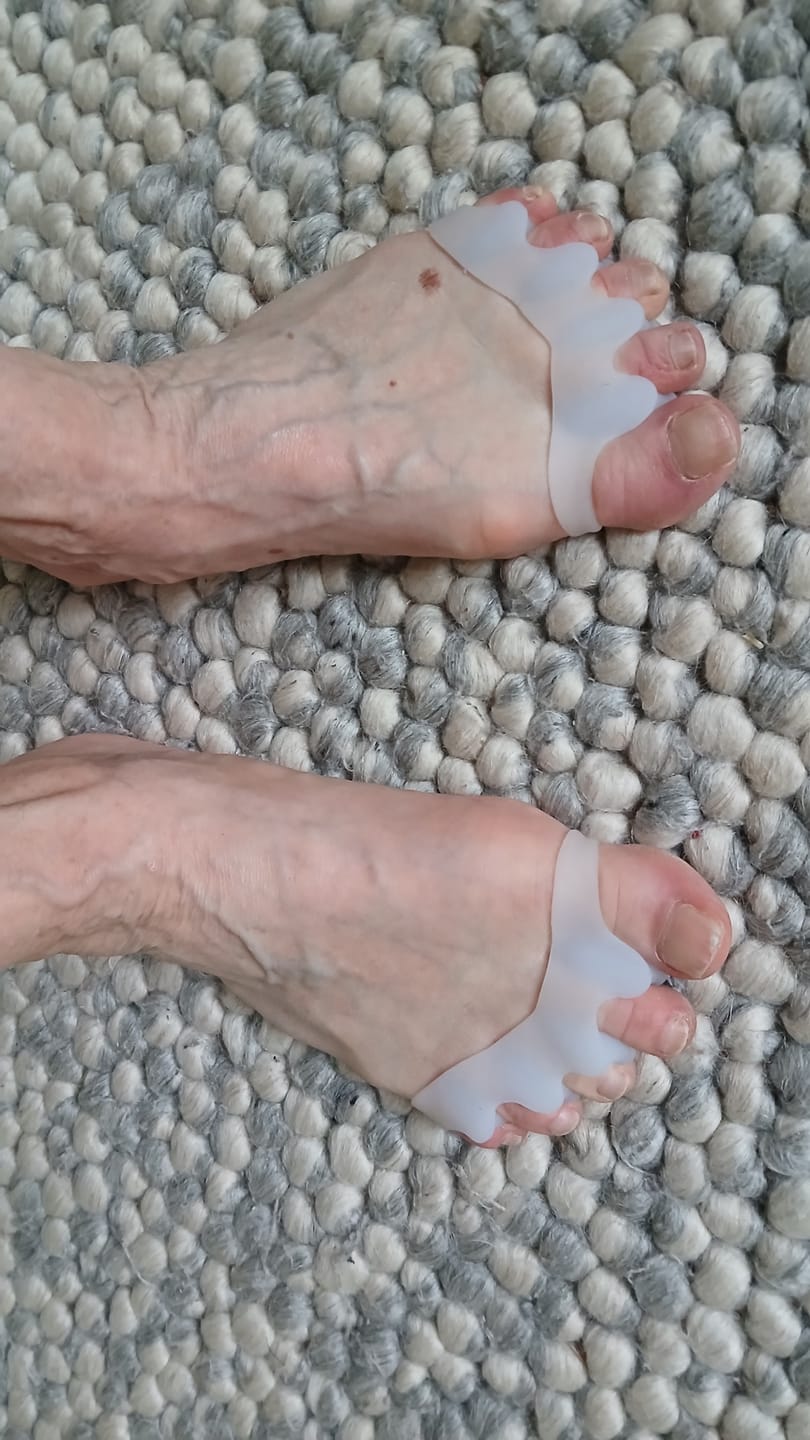 Customer photo review of Vaistoa Varpaiden Erottajat