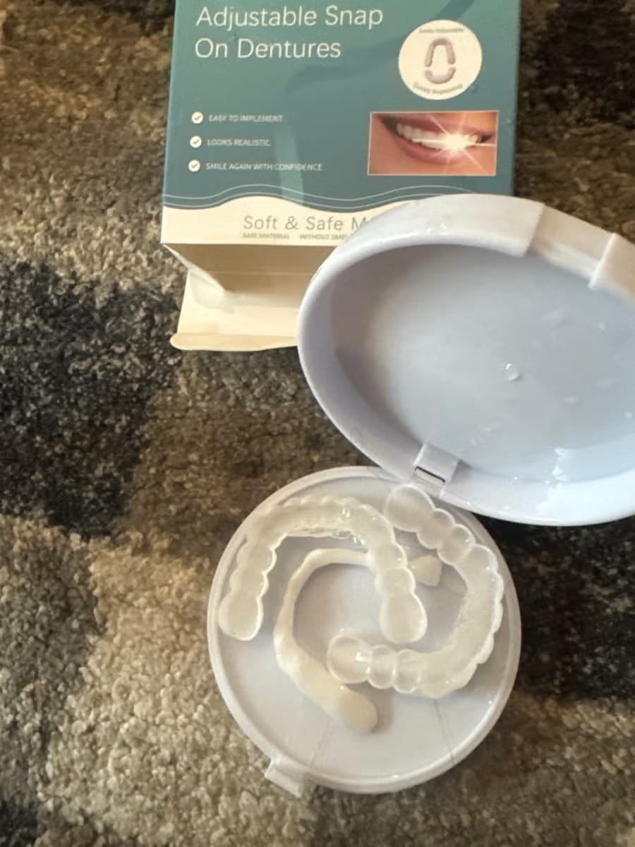 Customer photo review of Snap-On Veneers — Your Smile, Your Confidence (Pack of Two Veneers)