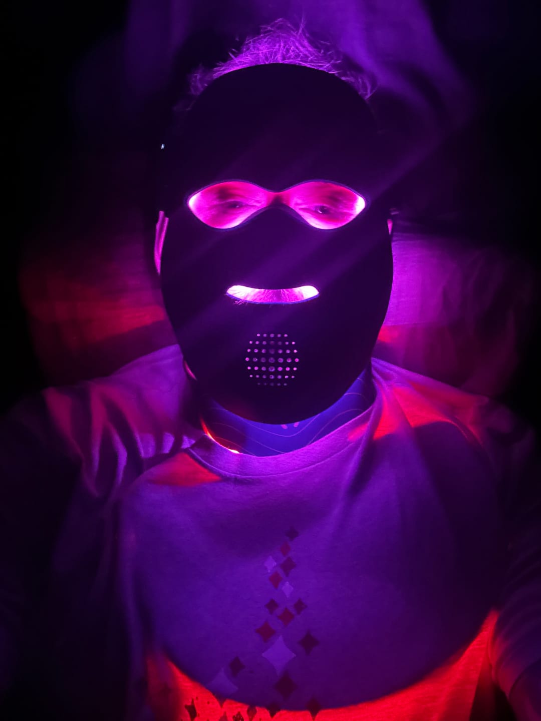 Customer photo review of INIA GLOW 4D Face & Neck Pro Kit