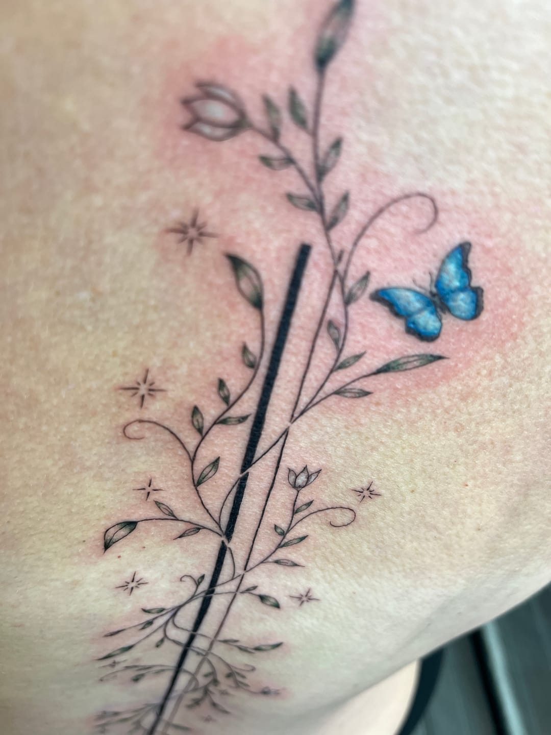 Customer photo review of EMALLA Eliot Fineline Tattoo Cartridge Needles Round Liner (Box of 20)