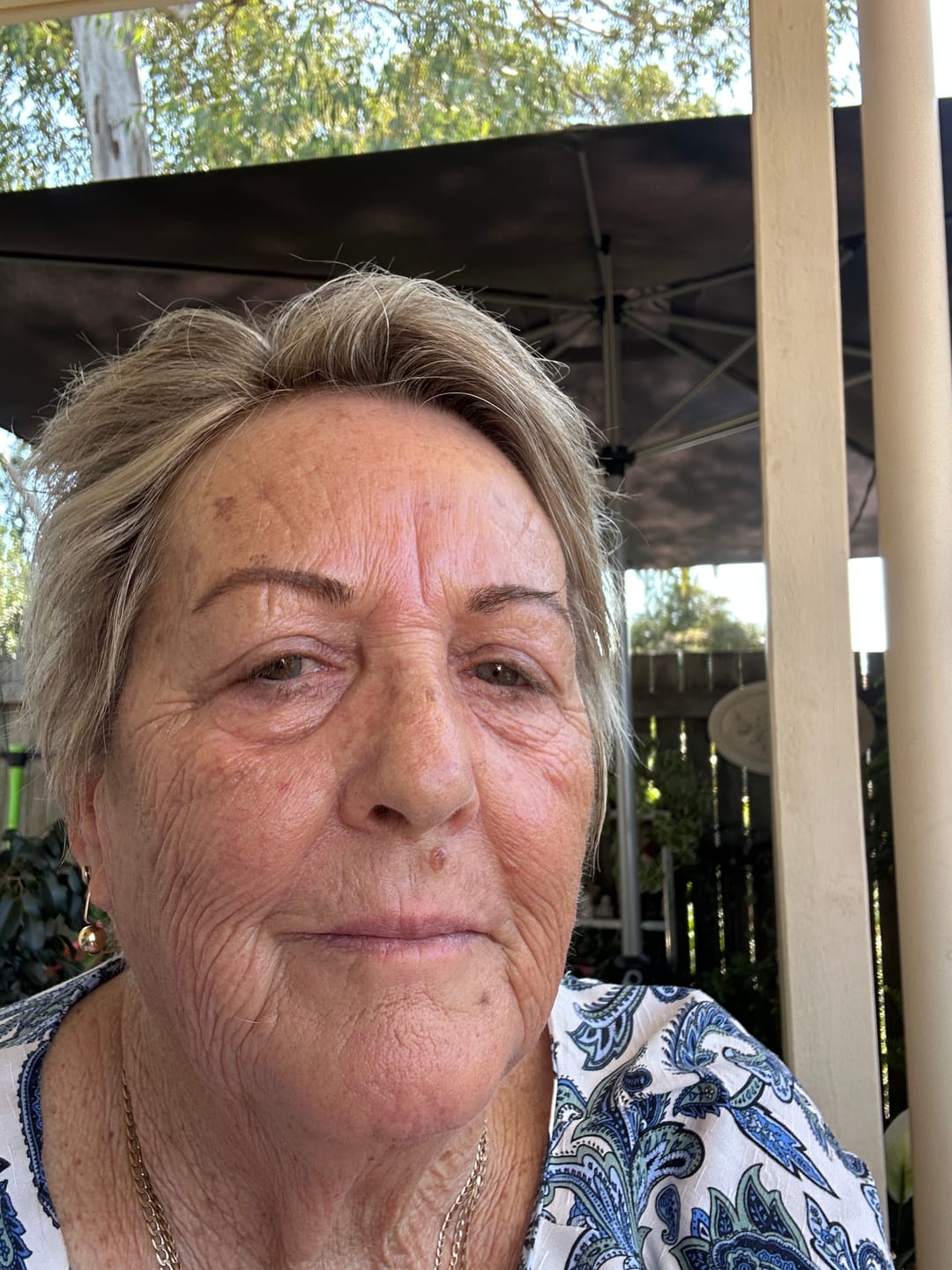 Customer photo review of Restore Serum