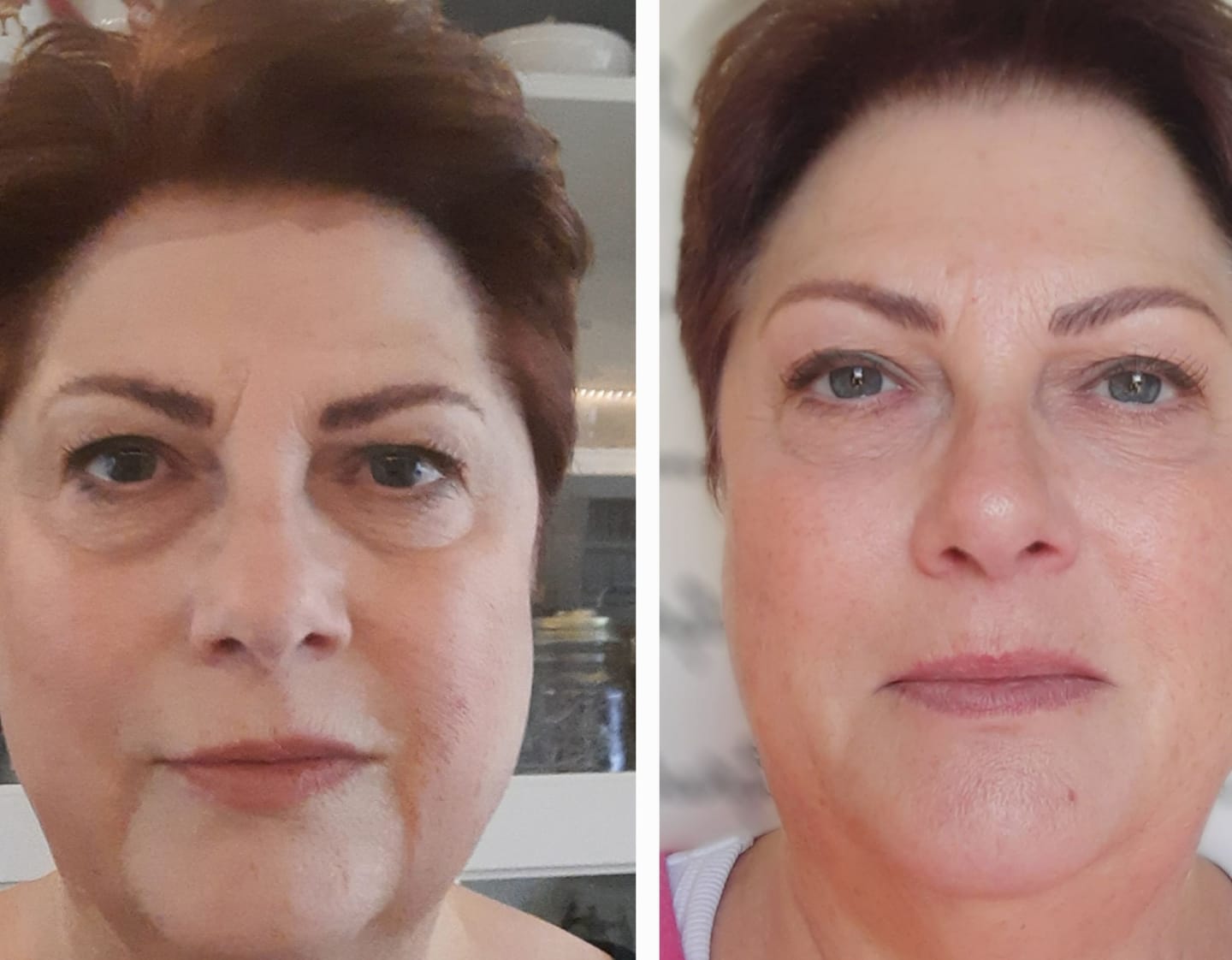 Customer photo review of Bio-Collageen Masker + Kwast