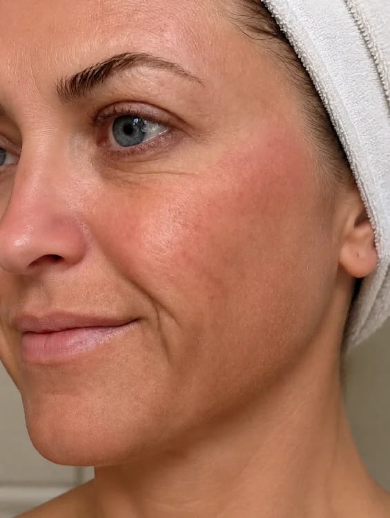 Customer photo review of Face Lift Massaggiatore Viso Lifting per lifting, Rassodante, Antirughe | Massaggiatore Viso Antirughe