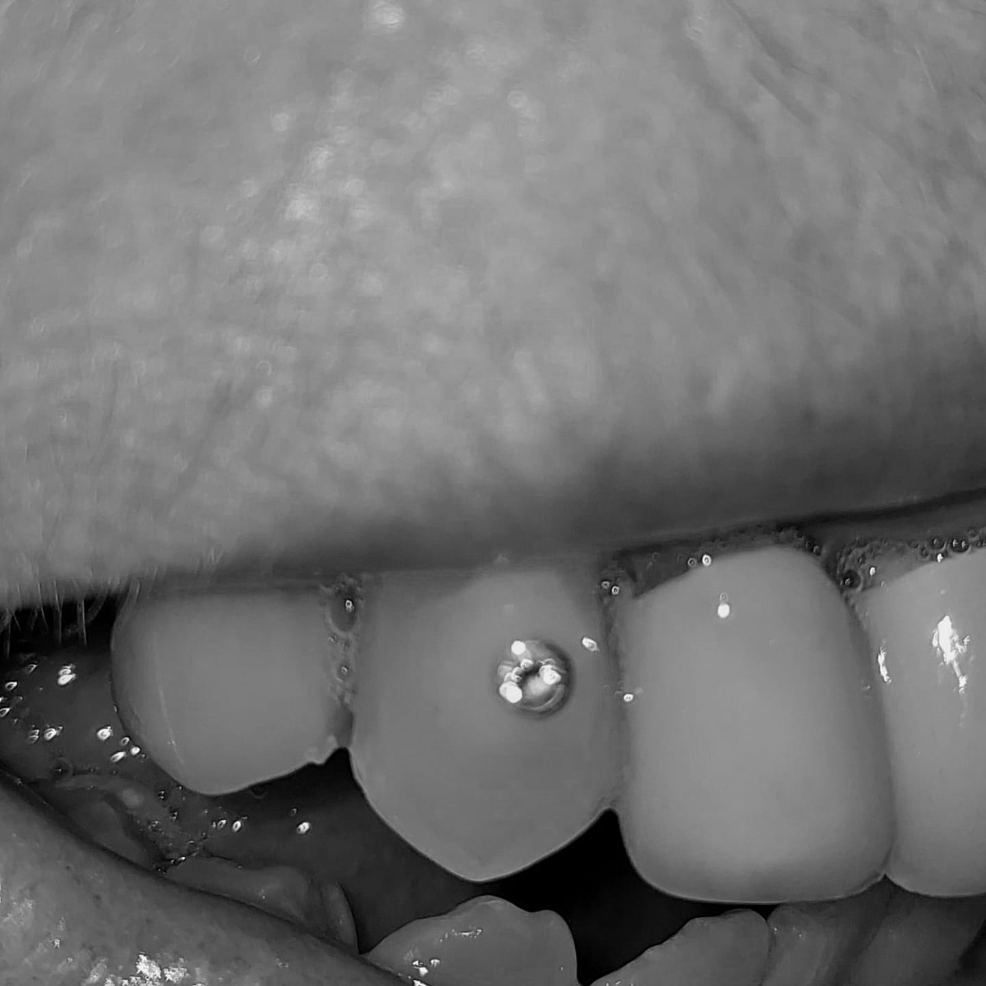 Customer photo review of Round w. Diamond 0.02ct Tooth Gem – 22k Gold | Twinkles