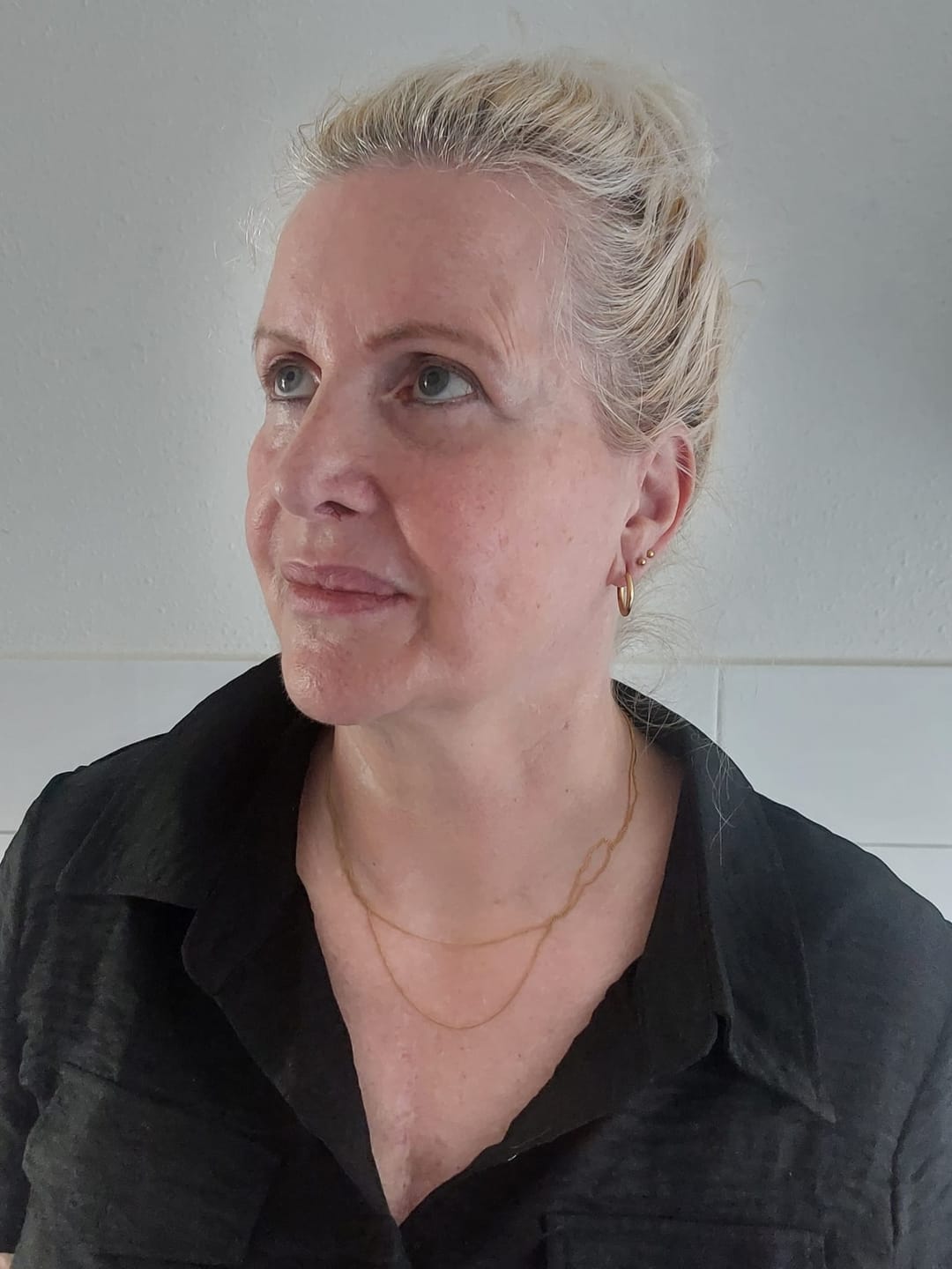 Customer photo review of DayBright Concealer