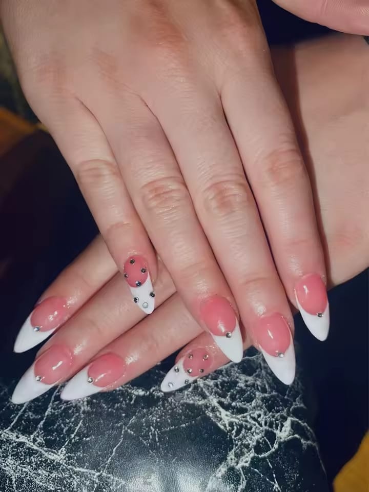 Customer photo review of Lunexor Gel Kit™