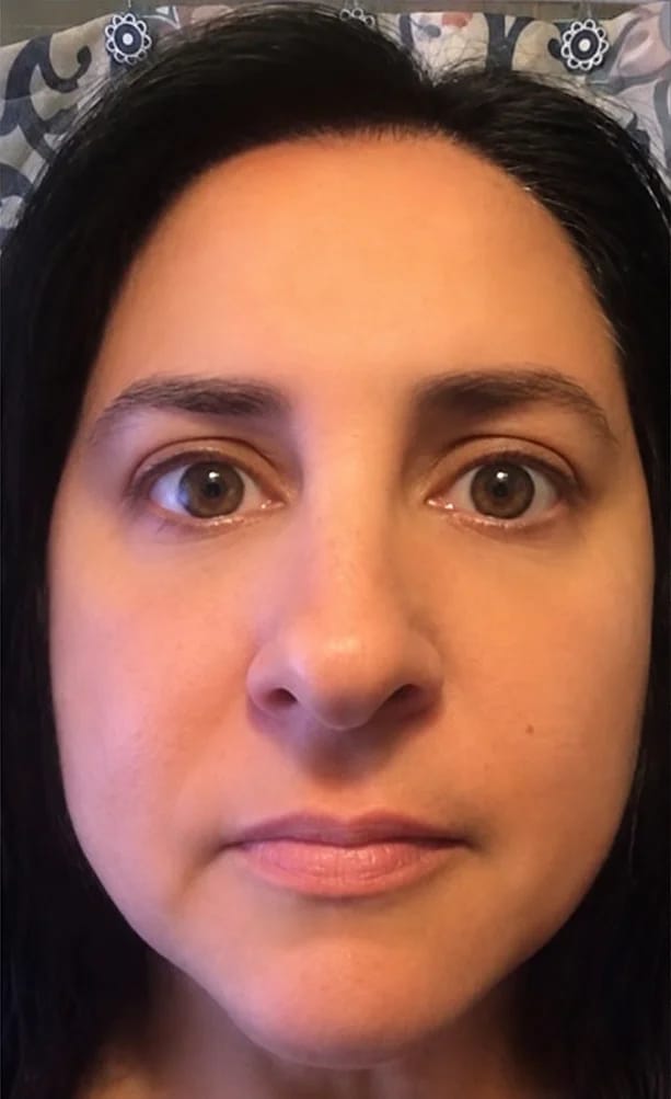Customer photo review of Face Lift Massaggiatore Viso Lifting per lifting, Rassodante, Antirughe | Massaggiatore Viso Antirughe