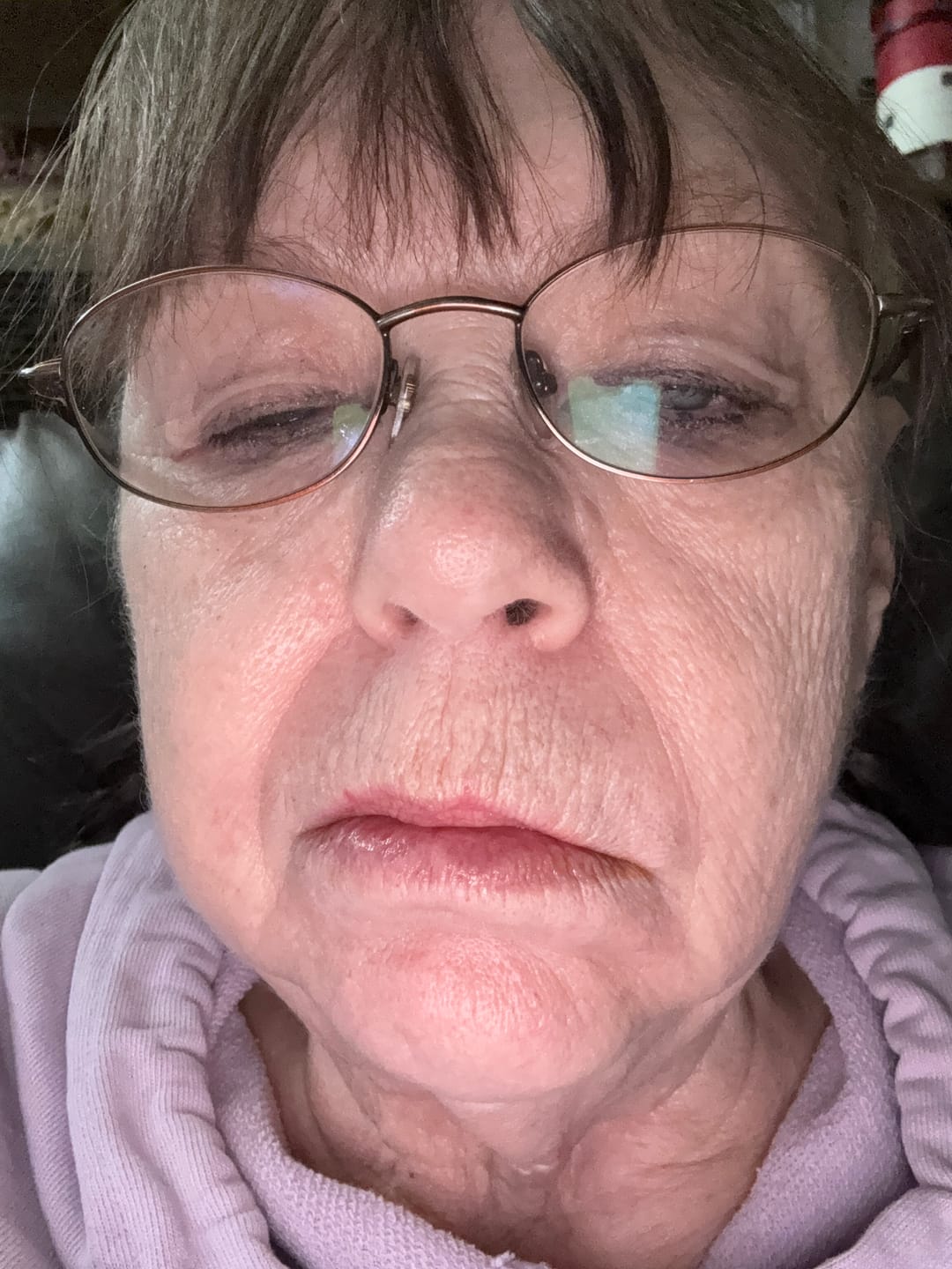 Customer photo review of Honey Bee Balm