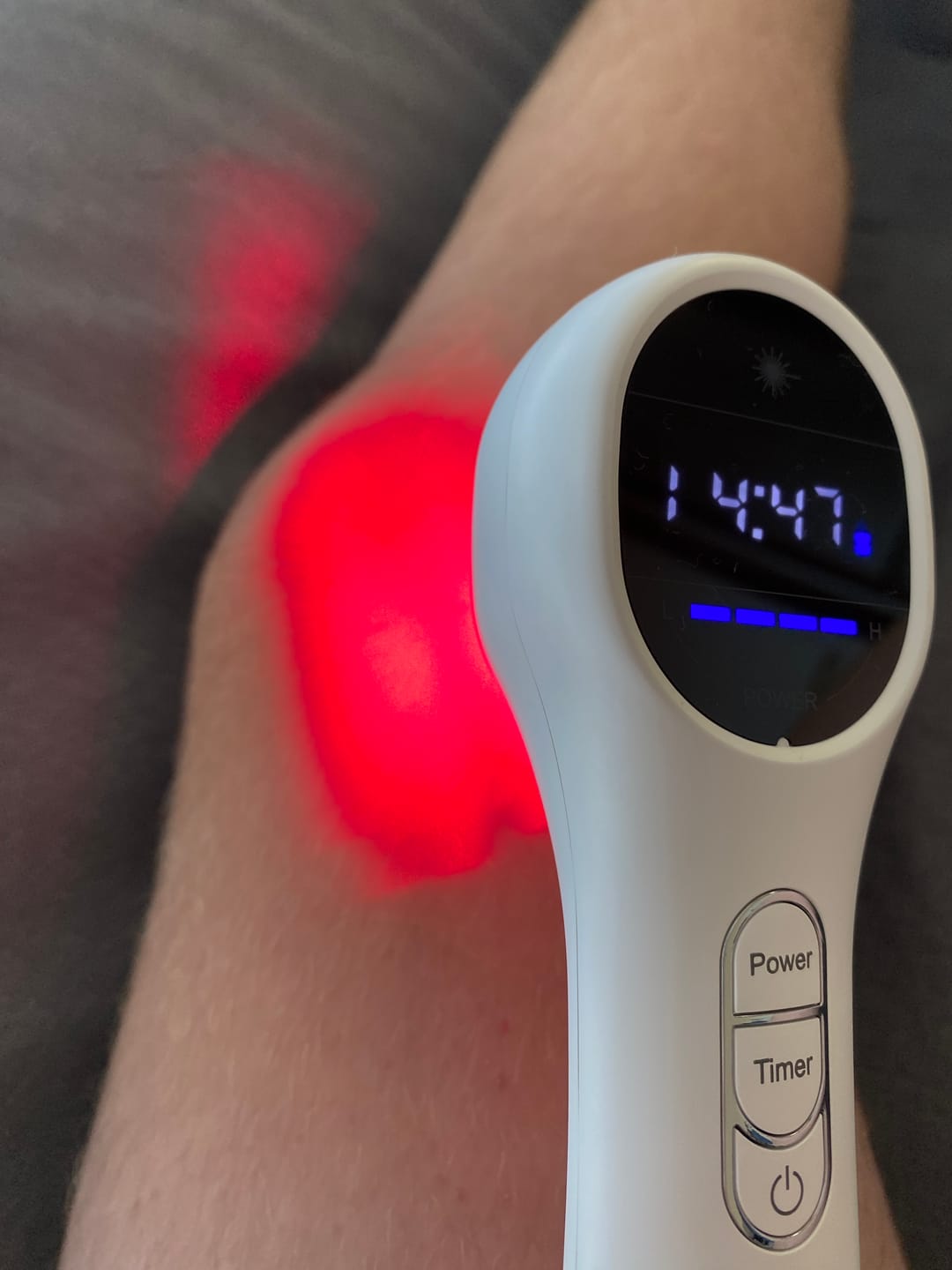 Customer photo review of DR SKINPRO® - Infrarot Schmerzlaser