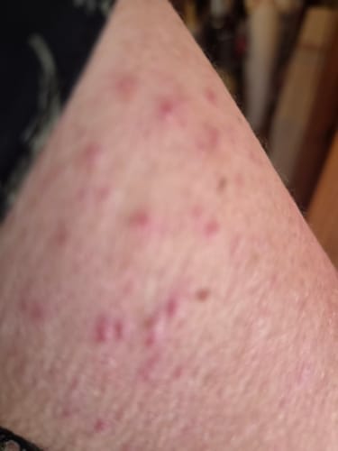Customer photo review of Harvest & Hive™ Organic Tallow Balm - Made in the UK 🇬🇧